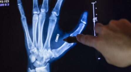 Σουηδία: Χιλιάδες πολίτες εμφυτεύουν μικροτσίπ στα χέρια τους για να μην μεταφέρουν κλειδιά και κάρτες!