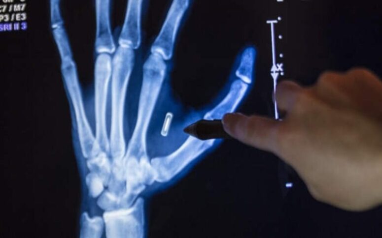 rfid-chip